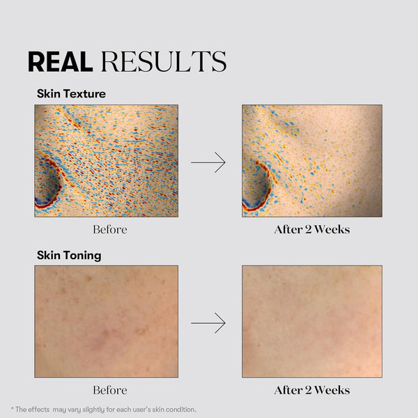 Kapsulu esence pigmentācijas plankumu novēršanai VT Cosmetics TX-Toning Essence 1000 Shot